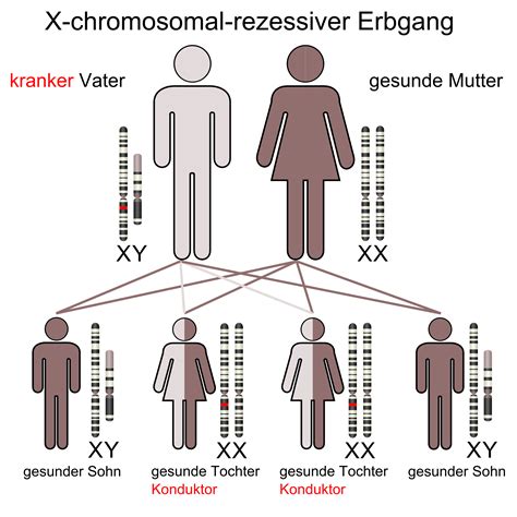 Erbleiden