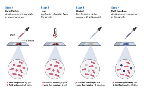 Ziehl Neelsen Technique Afb Staining Biorender Science Off