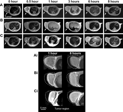 In Vivo T 1 Weighted MrI Images Of A Gd DTPa B Gd SWcNTs COOh