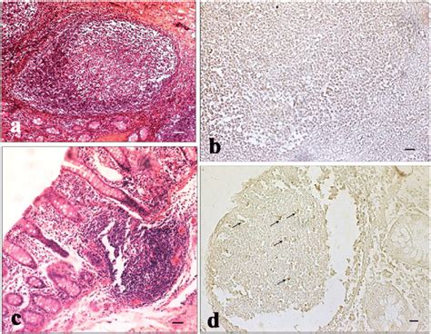 Immunohistochemical Analysis Of Cyclooxygenase Cox In The Ileum