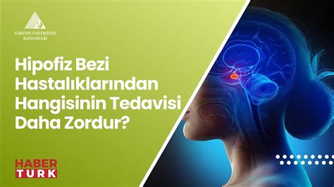 Hipofiz Bezi Hastal Klar Ndan Hangisinin Tedavisi Daha Zordur Youtube