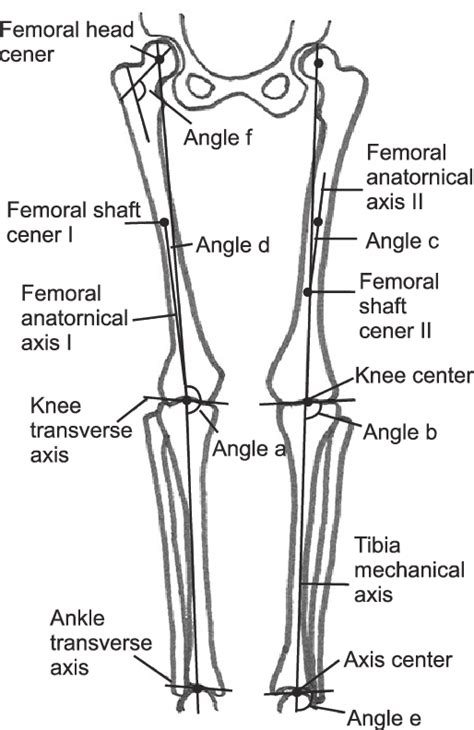 Lateral Distal Femoral Angle