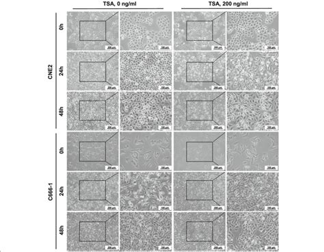 Morphology Of Npc Cells Treated With Tsa Cne2 And C666 1 Cells Were