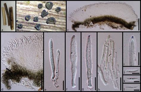 Morphology Of Neomollisia Gelatinosa MFLU 18 0701 Holotype A