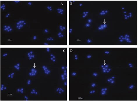 Detection Of Apoptotic And Normal Cells By Dapi Staining A Cells