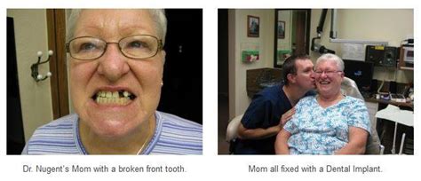 Replace Missing Teeth With A Dental Implant Pasadena Tx