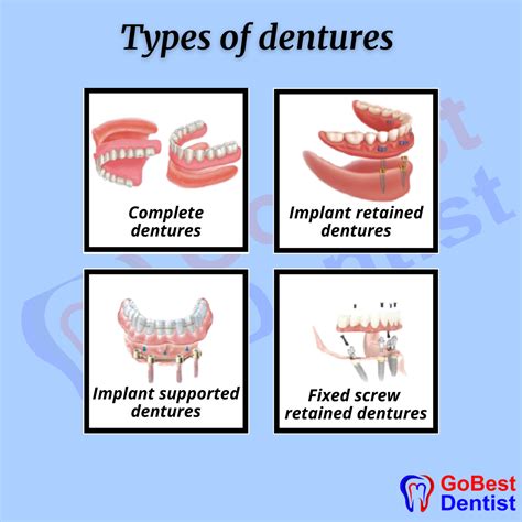 Flexible Partial & Complete Denture - Gobest Dentist