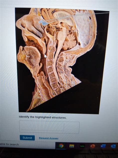 Solved Identify The Highlighted Structures Submit Request Chegg