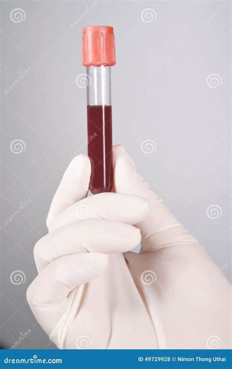 Hand Holding Blood In Test Tube Stock Photo Image Of Examine Cell