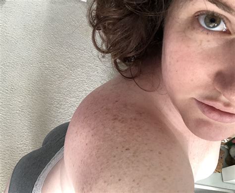 Fresh face Vacation freckles Canât lose ðŸ Porn Pic