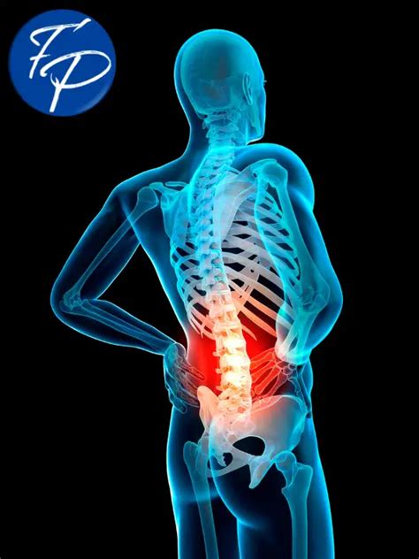 7 Proven Pinched Nerve Exercises Lower Back Pain Relief Facts And Physio