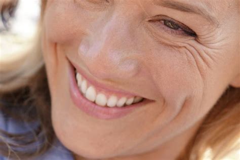 Cómo Conseguir Una Sonrisa Perfecta Clínica Dental Salamanca