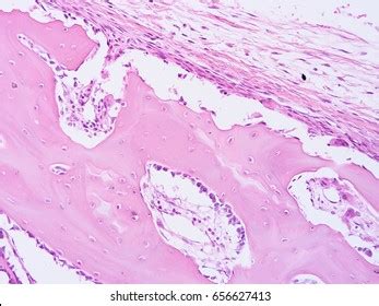 Histology Human Tissue Show Fibrous Cartilage Stock Photo 656627413 | Shutterstock