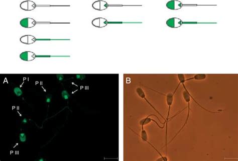 Classification Of Tyrosine Phosphorylation Tp Patterns Pattern I