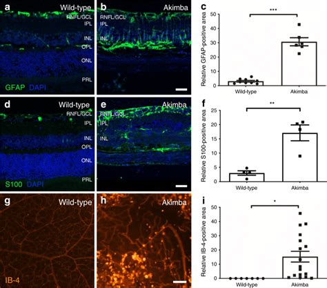 Histology Analysis Supports Reactive Macroglia And Immune Responses In