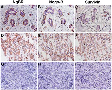 Immunohistochemical Ihc Staining Of Ngbr Nogo B And Survivin In