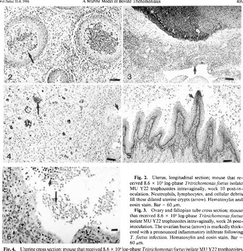 Figure 2 From Lesions Of Experimental Genital Tritrichomonas Foetus Infections In Estrogenized