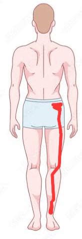 Sciatica in right leg? : r/Sciatica