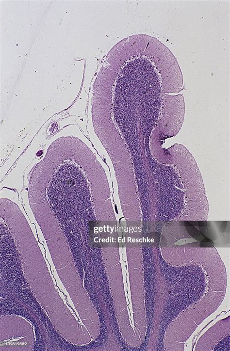 Cerebellum Brain 5x At 35mm Shows Gray Matter Of The Cerebellar Cortex