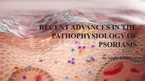 Recent Advances In The Pathophysiology Of Psoriasis Ppt