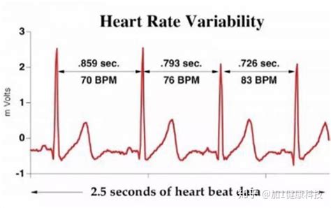 Hrv Hrv