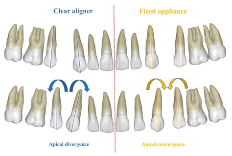 Applied Sciences Free Full Text Comparison Of Root Parallelism In