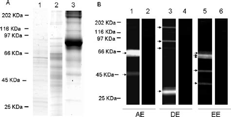 SDS PAGE And Gelatin Substrate SDS PAGE Analysis Of Aprotinin Agarose