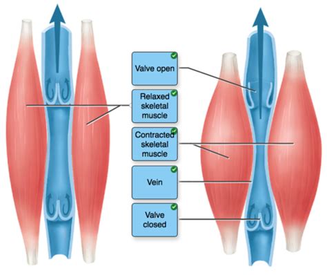 Venous Thrombosis Pulmonary Embolism PE Flashcards Quizlet