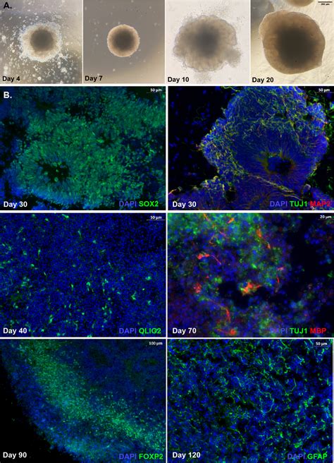 Representative Images From A Control Human Cerebral Organoid Hco A