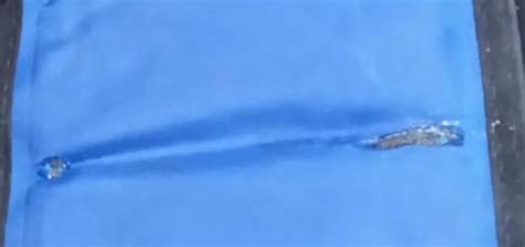 Cold Hot Therapy Wrap By Bodyprox Reusable Gel Pack For Pain Relief Great For Sprains