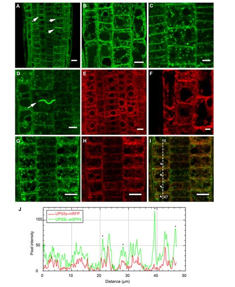 Subcellular Localization Of Atups L And Atups S In Arabidopsis Roots