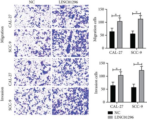 Linc Promotes The Proliferation Migration Invasion And Emt