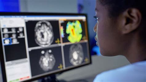 Brain ‘fingerprinting Provides Insights Into Mental Health Of Young