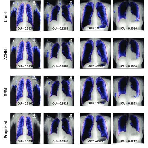 Segmentation Results On The Lung Segmentation Task Obtained From The