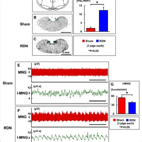 Location of the nucleus tractus solitarius (NTS) regions in the medulla ...