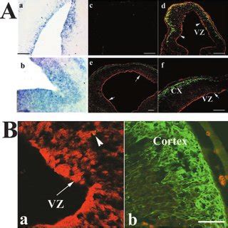 Atf Is Expressed Differentially In The Ventricular Zones Of E E