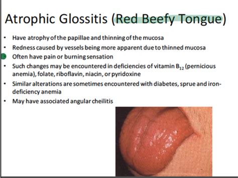 Atrophic Glossitis