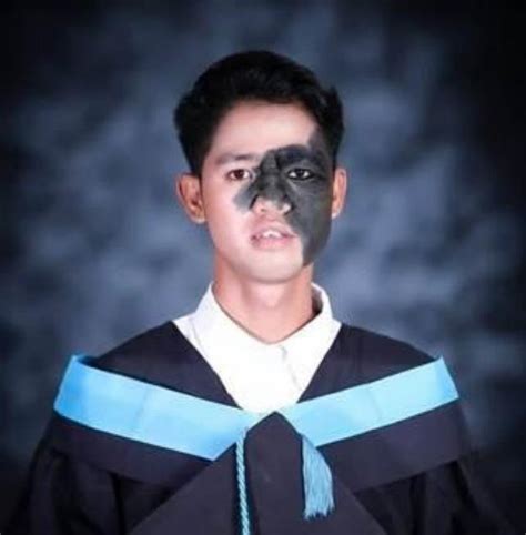 Ano Ang Mga Paraan Para Maiwasan Ang Leptospirosis Alamin Sa Pinoy Md