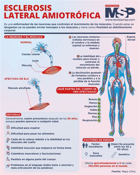 Esclerosis lateral amiotrófica