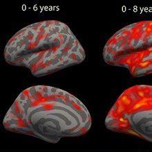 Estimation of cortical thinning dynamics. Colors represent the mean... | Download Scientific Diagram