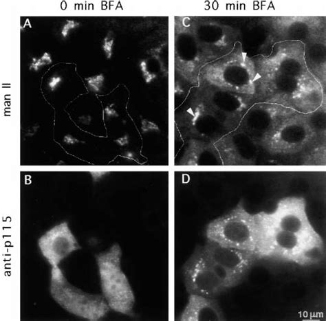 Antibodies Against P115 Do Not Block Bfa Induced Retrograde Golgi To Er