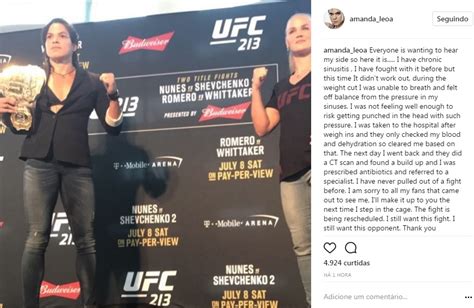 Amanda Nunes Explica Saída Do Ufc 213 Tenho Sinusite Crônica