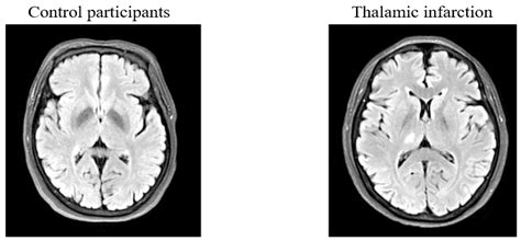 Brain Sciences Free Full Text Characterization Of Macular