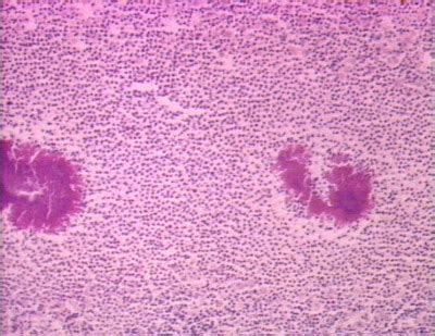 Actinomyces & Actinomycetes - WEBlogs21 Education: One New Idea Every ...