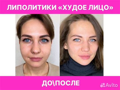 Косметолог, липолитики в Москве | Услуги | Авито