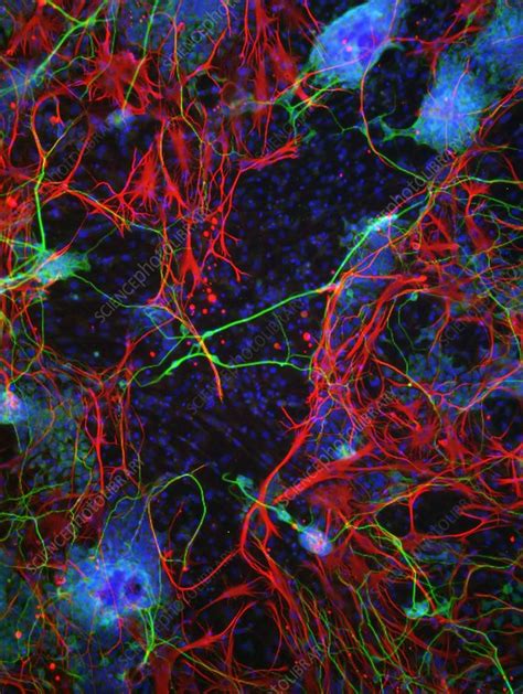 Stem Cell Derived Nerve Cells Stock Image C0148130 Science Photo