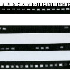 Analysis Of Gene Expression Levels Of P503S P504S And P510S By RT PCR