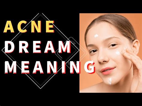 What Does It Mean To Dream About Acne StuffSure