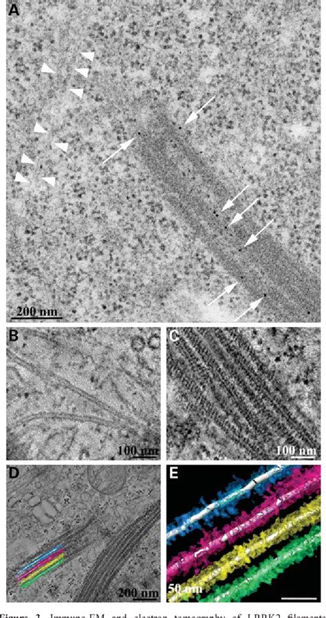 Figure From Lrrk Parkinson Disease Mutations Enhance Its Microtubule