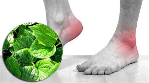 10 Cách Trị Bệnh Gout Tại Nhà Cách Trị Bệnh Gout Tại Nhà Hiệu Quả Và An